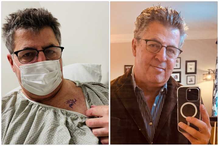 WTOP’s Neal Augenstein: 3 years after Stage 4 lung cancer diagnosis, what’s next
