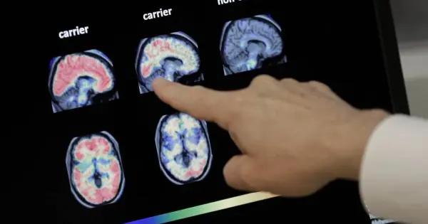 Periodismo Científico reconoce trabajo sobre Alzheimer