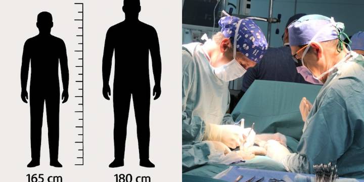 Peruanos están cansados de medir 165 cm en promedio: hombres se someten a costosa y dolorosa cirugía para ser más altos