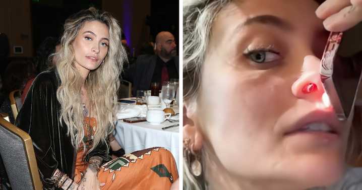 “It Ruined My Life”: Paris Jackson Reveals How Substance Use Deformed Her Face