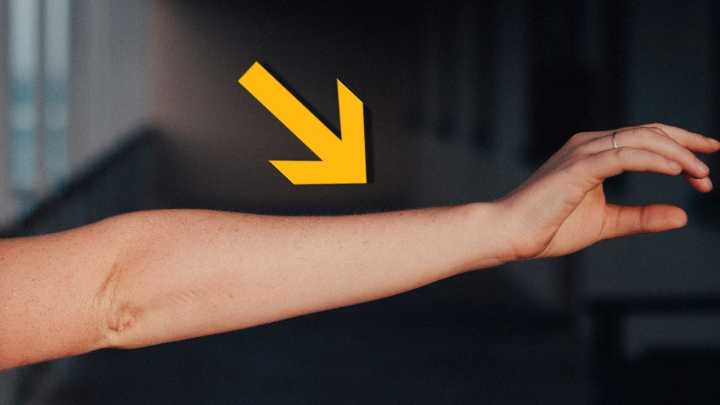 Human Arms Keep Growing an Extra Artery, Showing We're Still Evolving