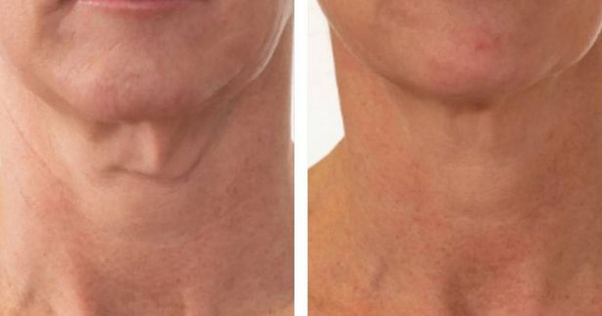Wrinkle cream that 'smooths out lines like magic' sells every 30 seconds