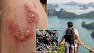 Bali tourists warned about painful threat after Aussie woman left with shocking rashes