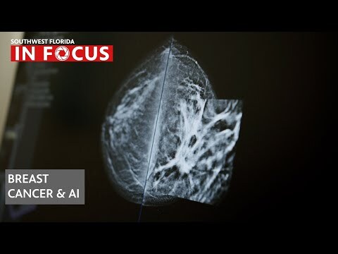 Artificial Intelligence joins the battle against breast cancer