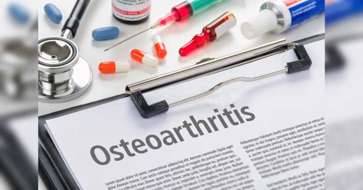 Building Strength, Restoring Movement: Together Against Osteoarthritis
