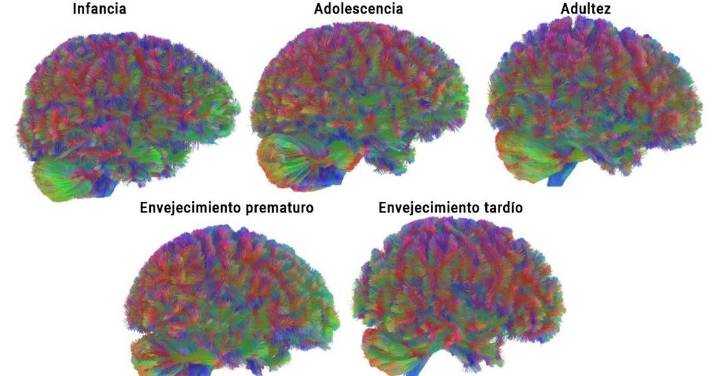 Las cinco etapas del cerebro, que cambia a los 9, 32, 66 y 83 años