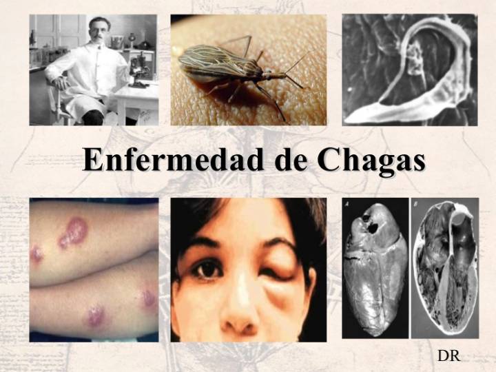 Siete municipios de Casanare han notificado casos de la enfermedad de Chagas