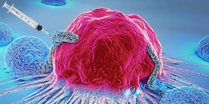 ¿Virus del herpes contra el cáncer? La revolución oncolítica que ya está en marcha