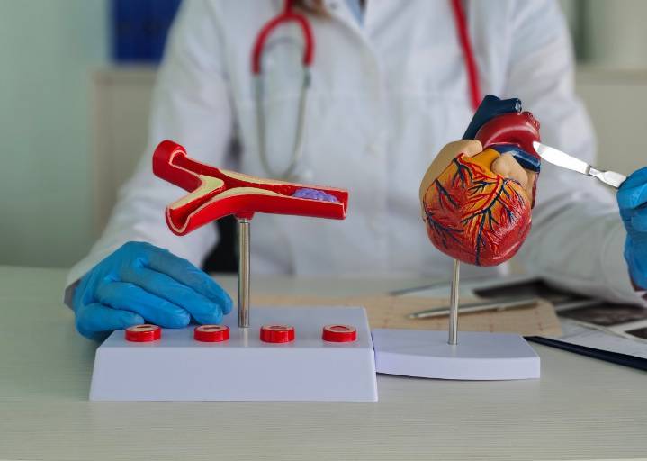 3 formas naturales de mantener las arterias limpias