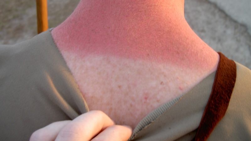 Last Chance to Work on Your Farmer's Tan this Weekend