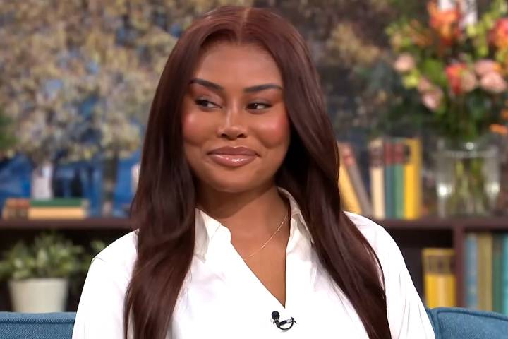 Woman Reveals Results of Facelift Procedure Conducted at Age 28