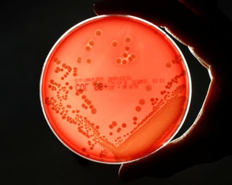 Deaths linked to antibiotic-resistant superbugs rose 17% in England in 2024