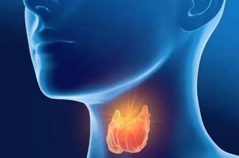 Hipotiroidismo en el adulto: qué tener en cuenta para un tratamiento adecuado