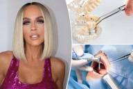 Inside Jenny McCarthy's infections from a failed dental implant