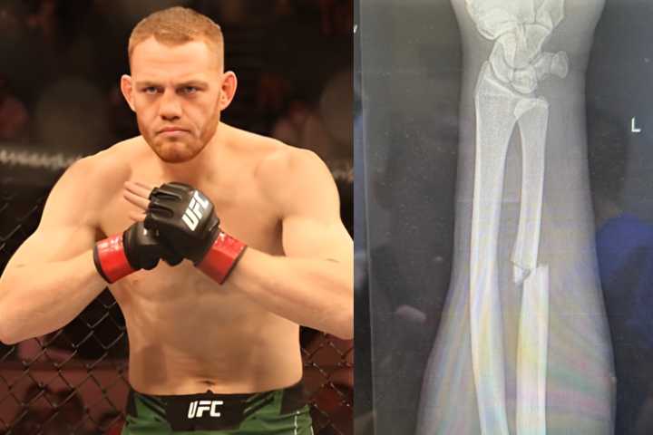 Jack Della Maddalena’s Broken Arm at UFC 299: How He Beat Gilbert Burns With Fractured Forearm