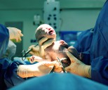 Alarm at GMCH Nagpur: Caesarean deliveries outnumber normal births: RTI data