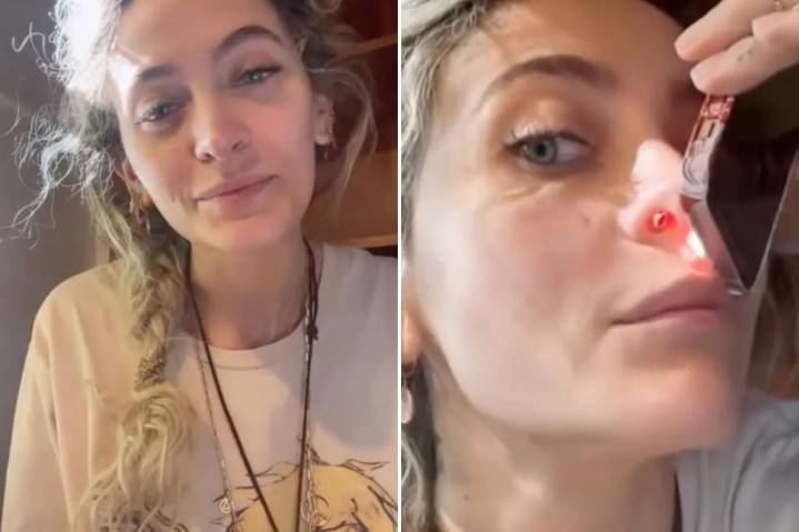 What is a perforated septum? Paris Jackson reveals scary drug side effect