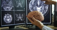 Your Brain Changes in Stages as You Age, Study Finds