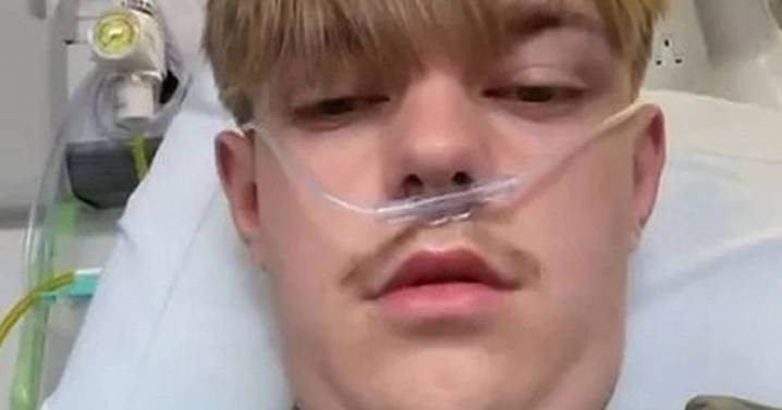 Parents warned as Shropshire teen, 17, coughs blood after trying to 'fit in'