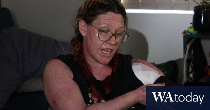 Greenfields firebomb attack: WA mum describes moment she was engulfed in flames