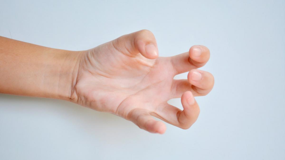 Día Europeo de la Distonía: visibilidad, empatía y lucha por un diagnóstico justo