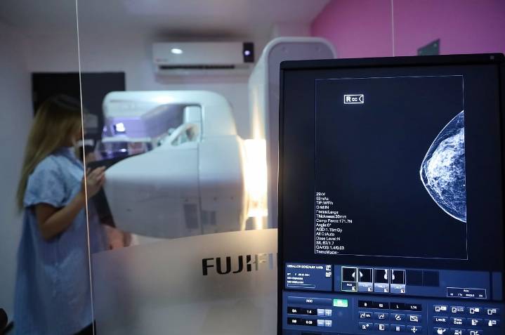 SSM realizará mastografías gratuitas en 10 municipios de Michoacán