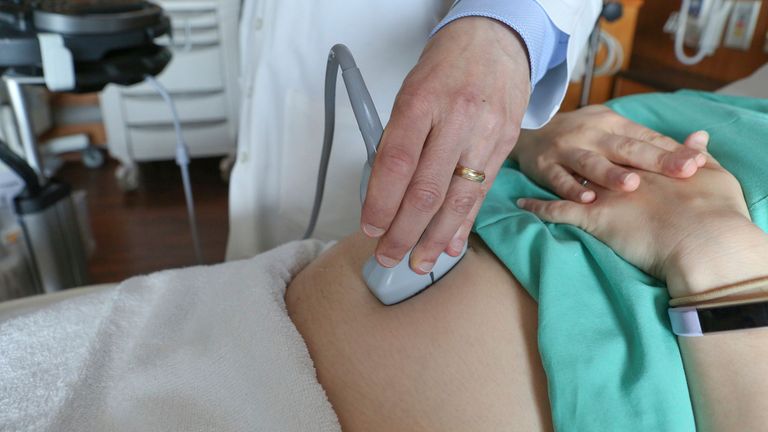 Radiographers raise concerns about 'unsafe' nature of high street baby and pregnancy scans