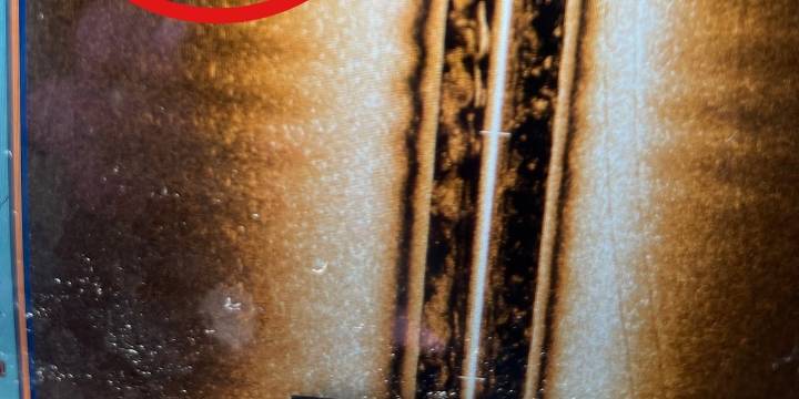 NOPD finds debris believed connected to missing plane in Lake Pontchartrain