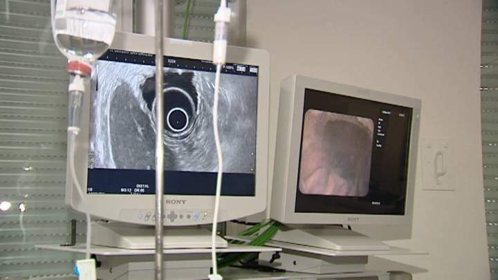 Madrid niega errores diagnósticos en cribados de cáncer pero sí reconoce incidencias en 500 comunicaciones por carta