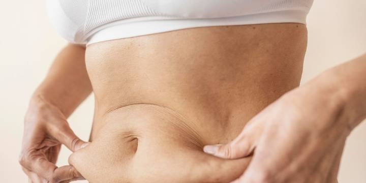 Flacidez cutánea después de perder peso: las opciones más efectivas para recuperar la firmeza