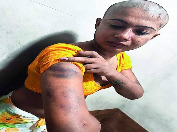 Seven arrested for assaulting fellow trans woman