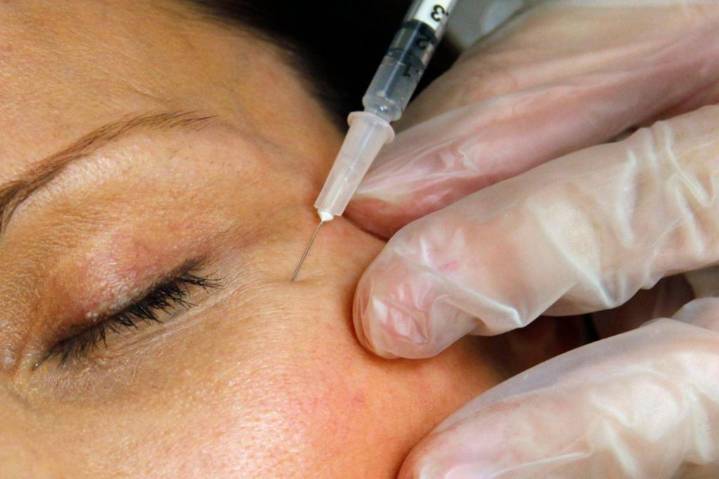 FDA warns websites selling unapproved Botox for cosmetic purposes