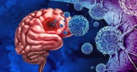 Traces Of Bacteria Found In Brain Tumors