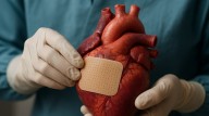 Crean “parche” que ayuda al corazón a repararse solo