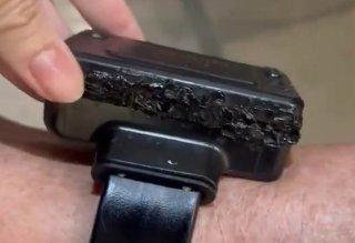 Bolsonaro alegó paranoia para justificar daño a su tobillera