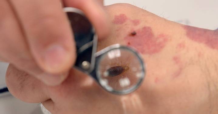 ¿Hay chinches en el Metro de CDMX? Te decimos qué hacer y cómo identificarlas (VIDEO)