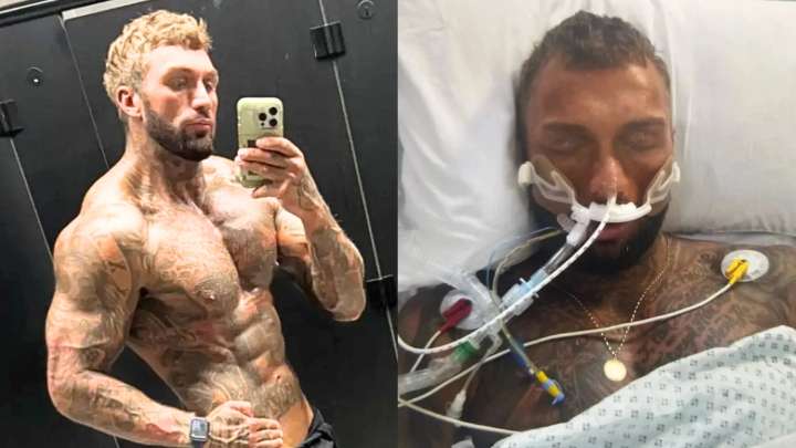Bodybuilder Forced Into Medically Induced Coma After Abusing Steroids for 2+ Years