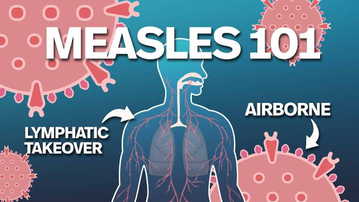 Measles: Understanding the most contagious preventable disease