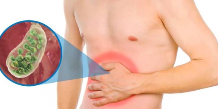 ¿Qué tan grave es tener piedras en la vesícula? Cinco alimentos que provocan este padecimiento 