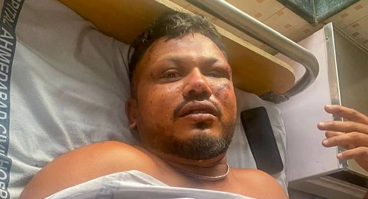 ‘Every day is painful’: Air India crash survivor speaks of his struggle to cope