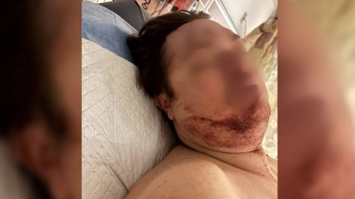 Man's skull crushed by angry group after Midtown car crash