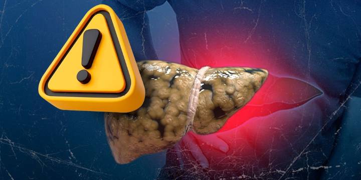 ¿Cuánto tiempo toma revertir el hígado graso con cambios en el estilo de vida?