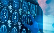 No es en la adolescencia: científicos revelan la edad en que el cerebro llega a la madurez y cuándo empieza a envejecer