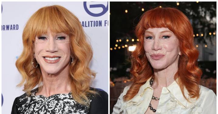 Kathy Griffin, 65, Says Third Facelift Came at a Shocking Price