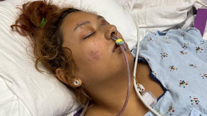 Family seeks justice after 20-year-old cyclist loses leg in crash