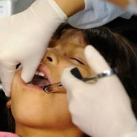 Countries agree to end mercury tooth fillings by 2034
