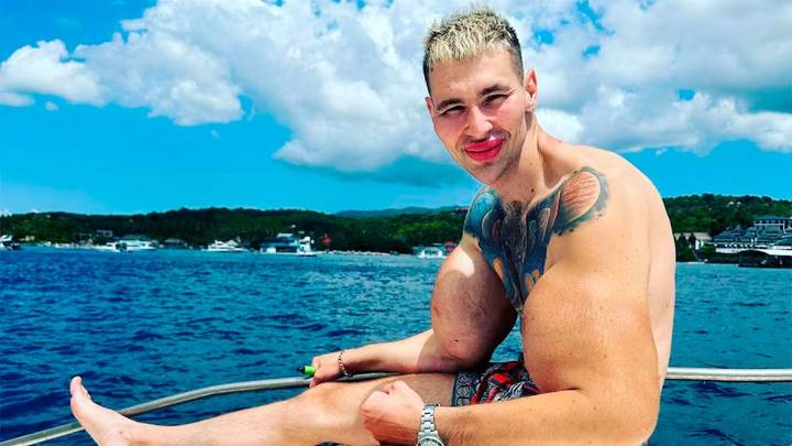 El “Popeye ruso” podría perder ambos brazos tras inyectarse vaselina en los bíceps: su estado es crítico