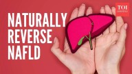 Reverse fatty liver naturally in 90 days: Here are 3 things to focus on