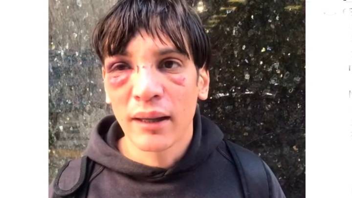 Exigen reapertura de la causa contra los agentes policiales que le dieron una brutal golpiza a Matías Darabos