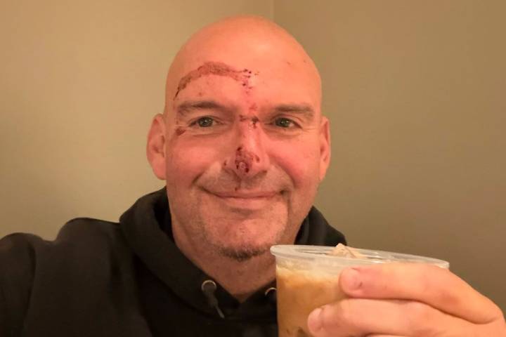Sen. John Fetterman Shares Photo of His Stitches After Falling and Being Hospitalized